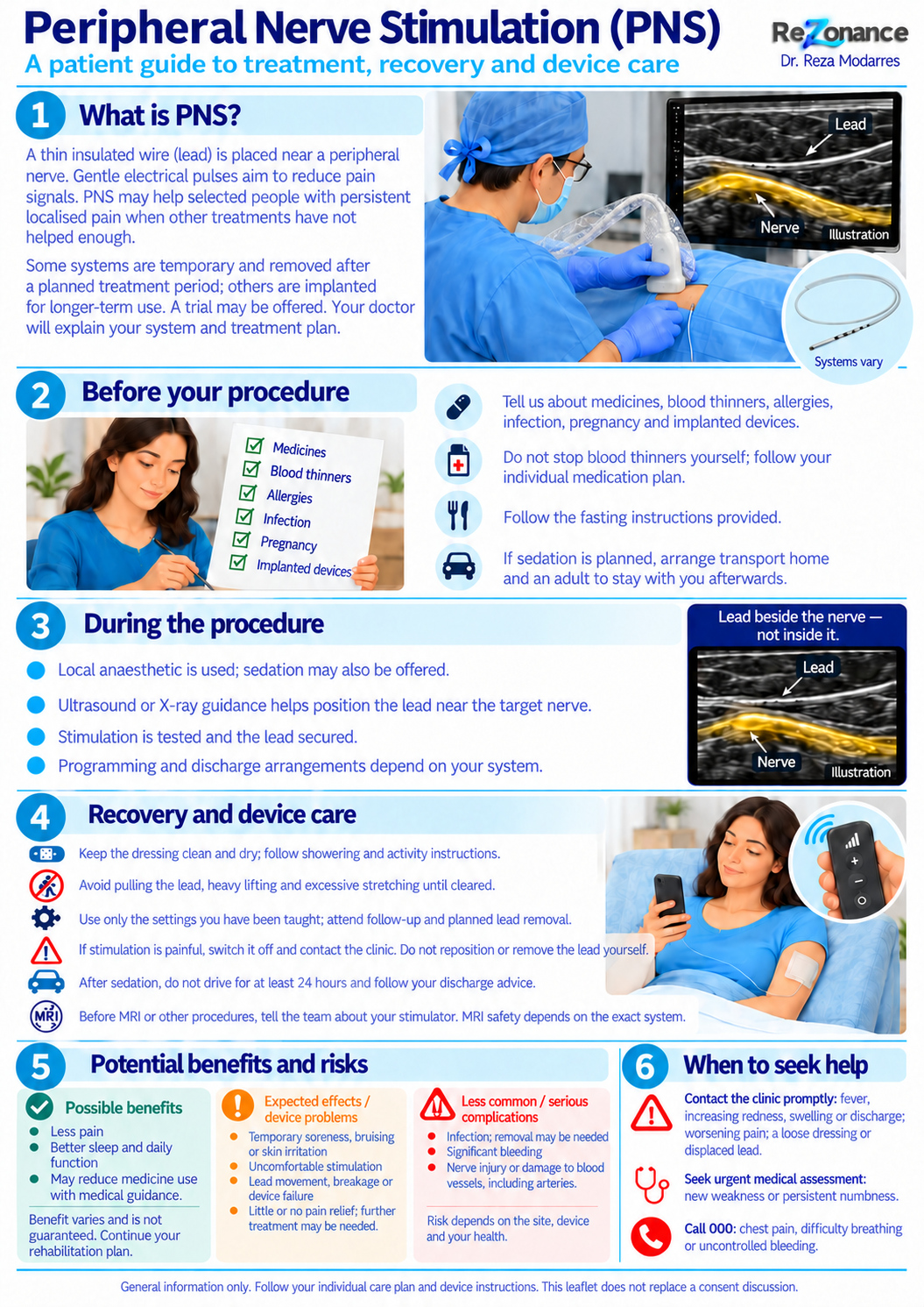 One-page patient flyer: Peripheral Nerve Stimulation